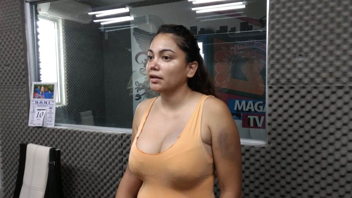 Propinan golpiza a ex pareja de alto funcionario de la Fiscalía