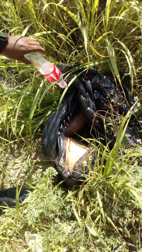 Hallan una pierna humana en la Región 104