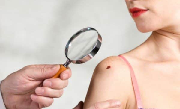 Importante observar el cuerpo para detectar señales de cáncer