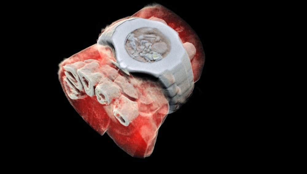 Surgen los rayos X a color y en tercera dimensión