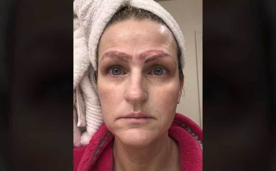 Mujer se somete a microblading y le sale con cuatro cejas