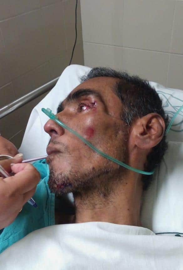 "Se les cayó" en el IMSS oficial de Tránsito y falleció