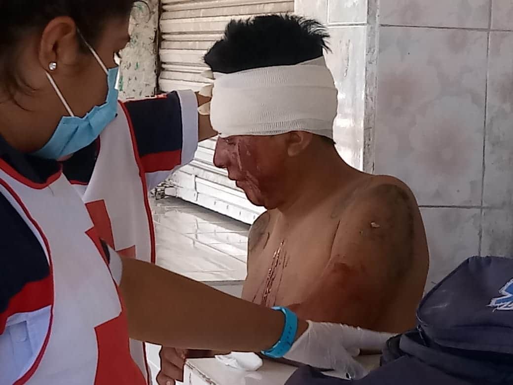 Por golpear a ladrón, lo meten a la cárcel