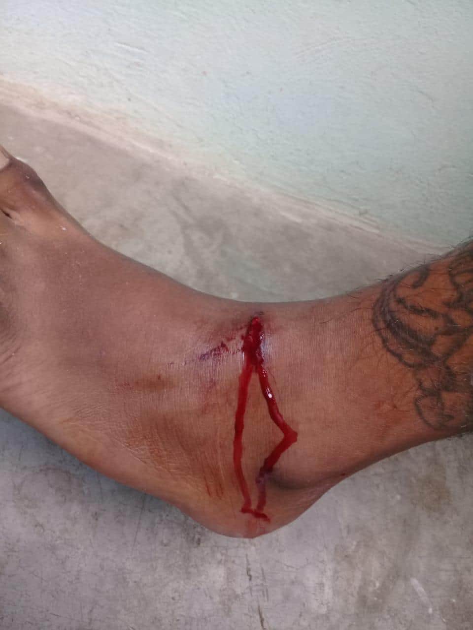 Acusa a policías estatales de “quererlo matar” a balazos