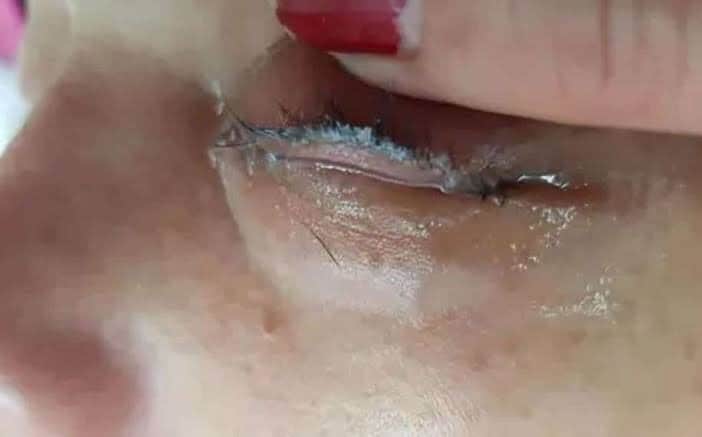 Le pegan los ojos con pegamento de uñas en salón de belleza y se hace viral