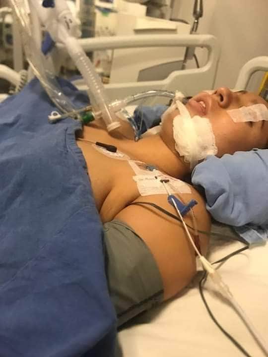 Piden justicia para joven gravemente lesionada tras ser impactada por patrulla en Playa del Carmen