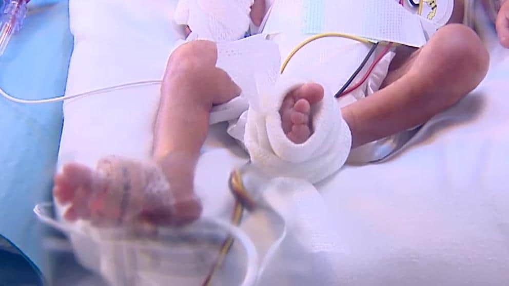 Grave, bebé que sobrevivió al asesinato de su madre; lo alcanzó el cuchillo