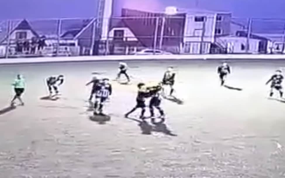 Le rompen la mandíbula a jugador en pleno partido de fútbol, ahora no puede hablar
