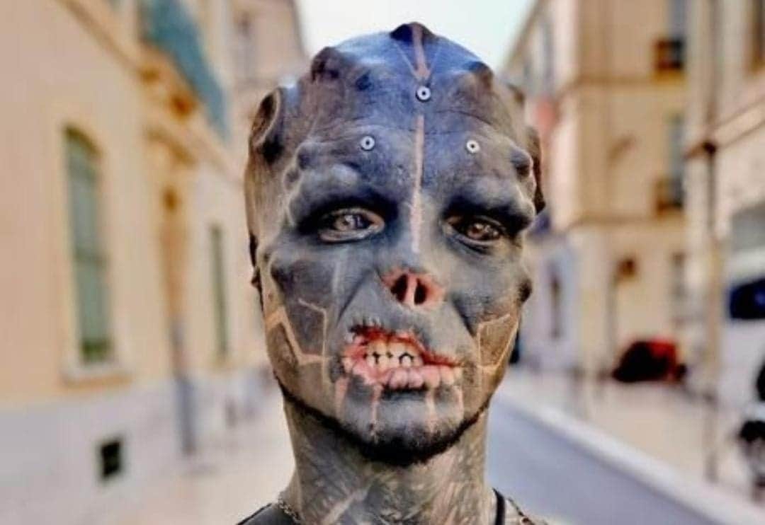 Black Alien se amputa los dedos de las manos y quiere nuevas piernas