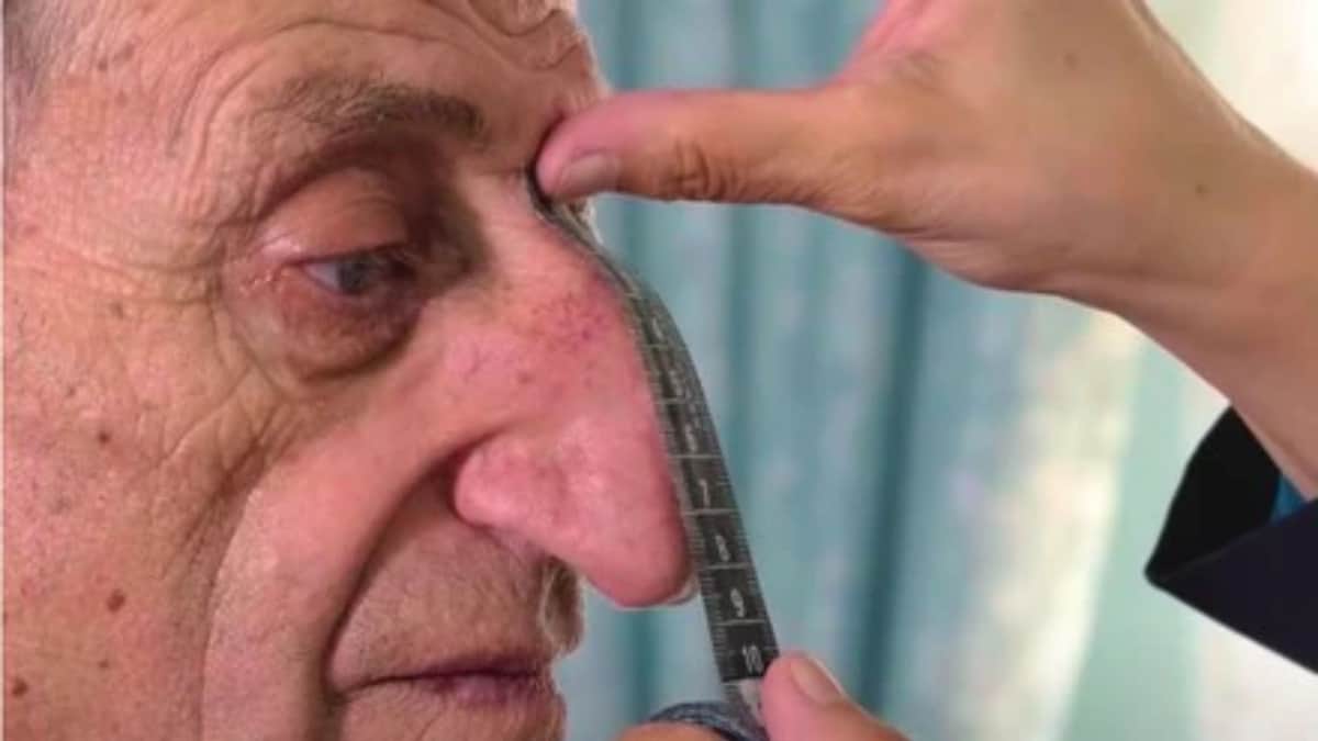 Dan Récord Guinness a hombre por la nariz más larga del mundo, mide 9 centímetros