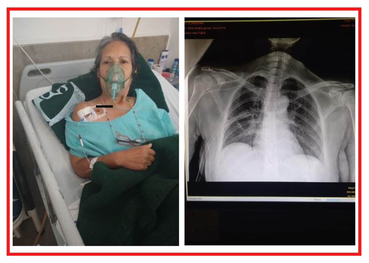 Denuncian NEGLIGENCIA en el IMSS: Fue a que le quitaran la vesícula y le perforaron el pulmón