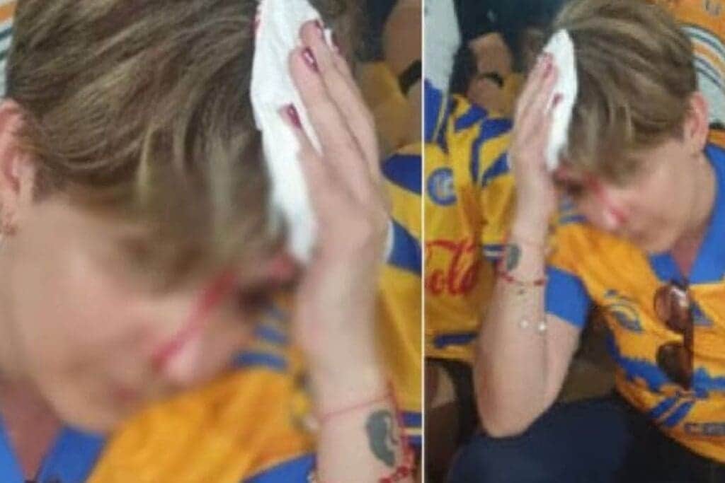 Aficionada de Tigres tuvo que ser atendida porque un pedazo del estadio le cayó en la cabeza