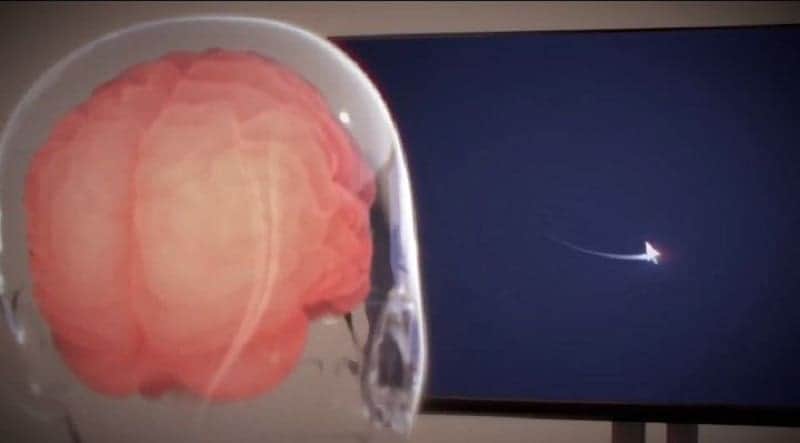 Primer paciente con chip cerebral puede controlar un ratón de computadora con el pensamiento