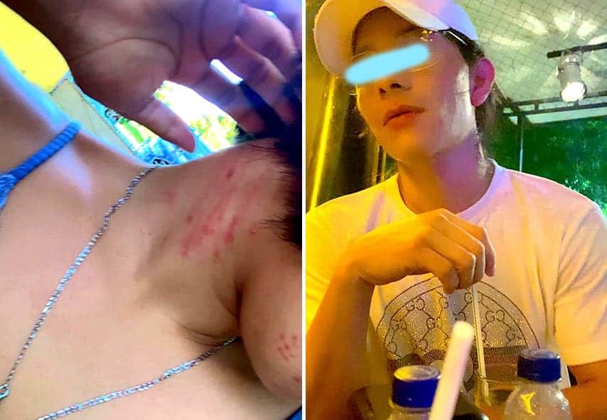 Video: Joven denuncia intento de feminicidio en Chetumal; la FGE minimiza el hecho