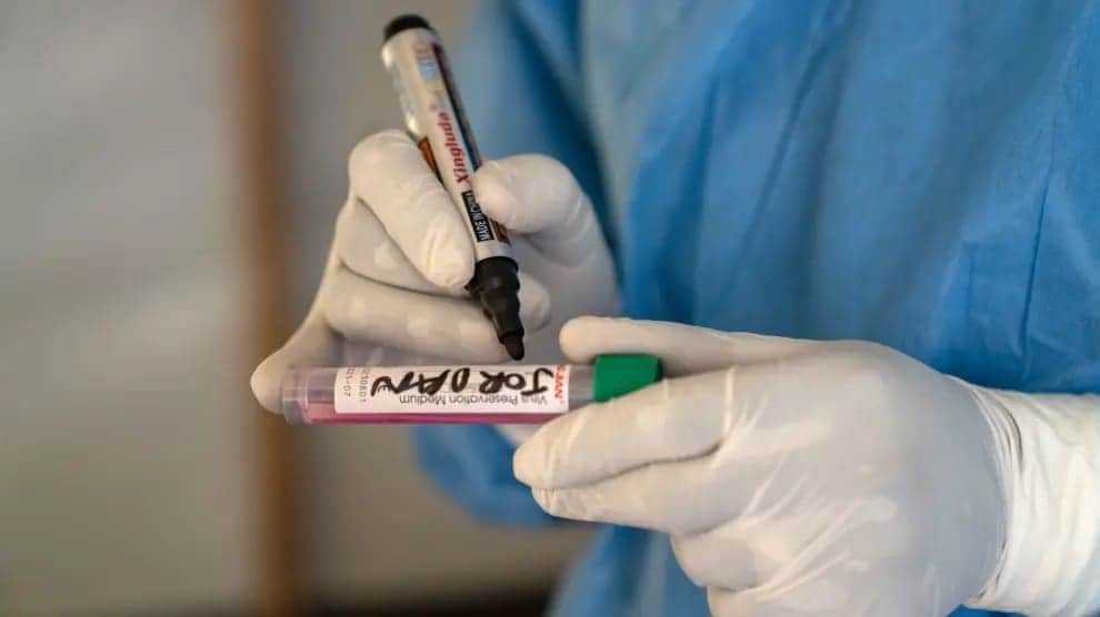 Viruela de mono en México está por alcanzar los 100 contagiados confirmados