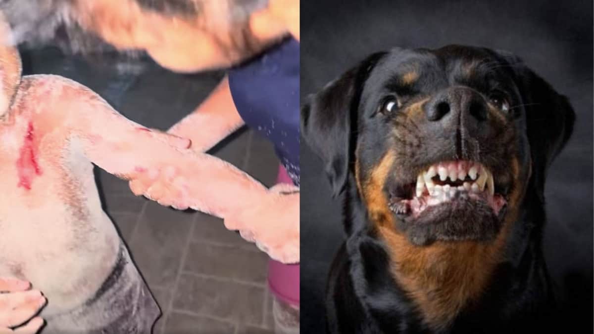 ¡OTRO ATAQUE! Niño es víctima de las mordidas de un rottweiler en zona turística de Playa del Carmen, el dueño huyó