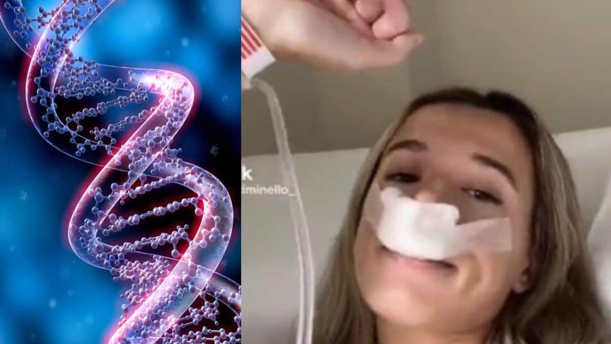 Video: Joven se hace la rinoplastia para "heredar" una nariz bonita a sus hijos