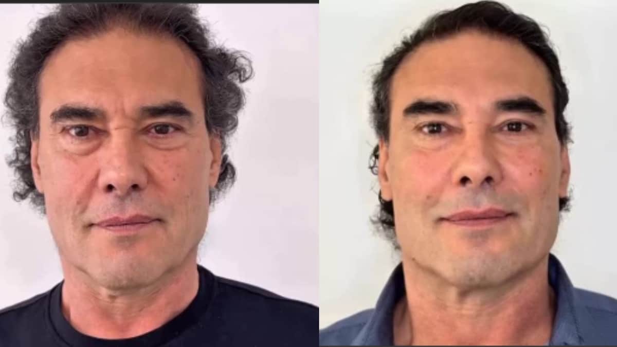 Actor Eduardo Yáñez se somete a cirugía de rejuvenecimiento facial y sorprende a fans
