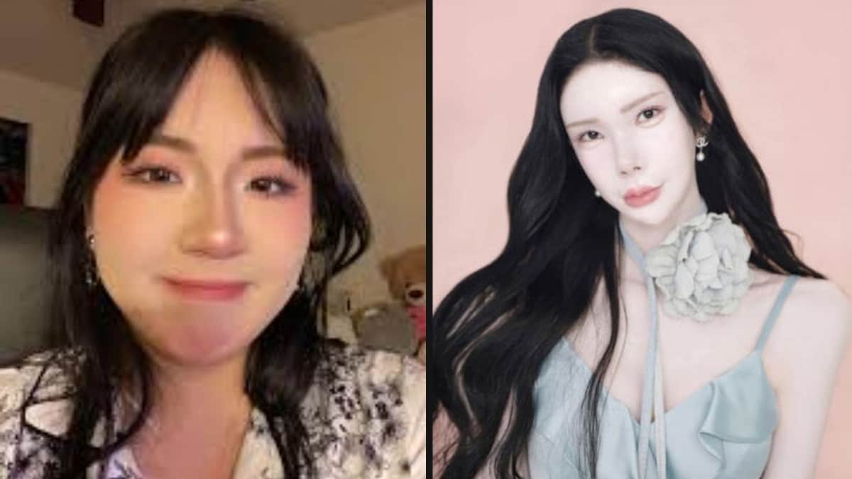 Joven de Austria se somete a varios procedimientos estéticos para parecer coreana y luce irreconocible