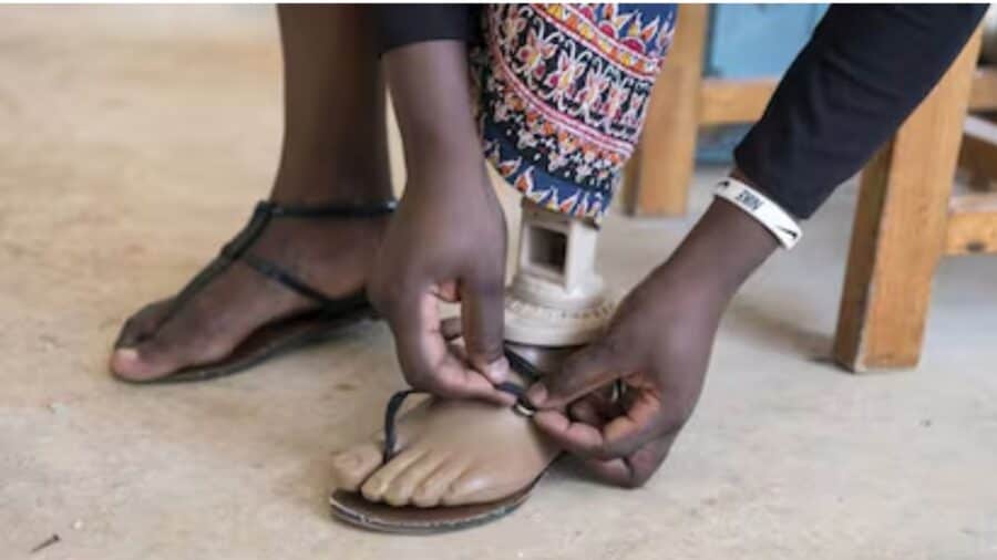 Joven se amputa un pie para ingresar a la facultad de medicina como persona con discapacidad en India