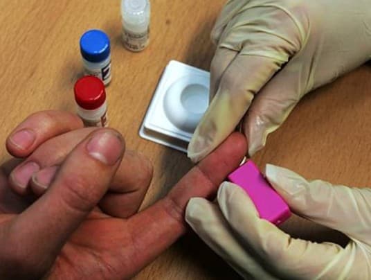 Vacuna experimental contra el VIH ya fue probada en 400 humanos