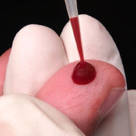 Alarmante incremento de VIH en Playa del Carmen