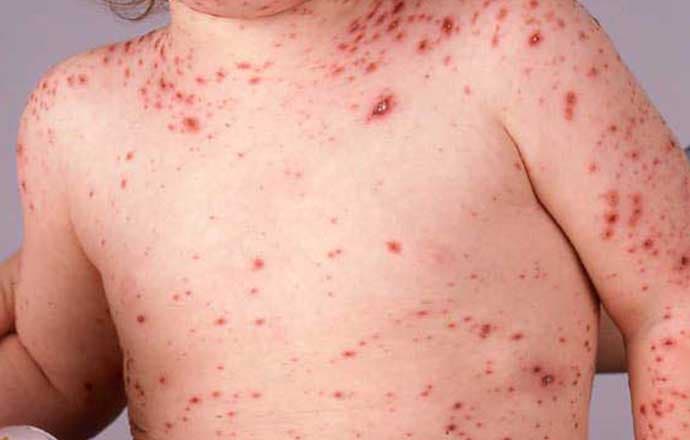 Mueren cuatro personas de forma misteriosa en Nuevo León