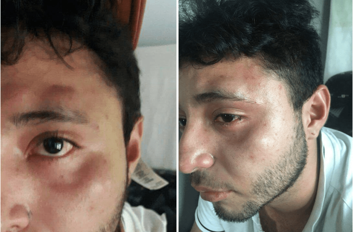 Ricardo Pimentel propina golpiza a estudiante por pisar un gato accidentalmente