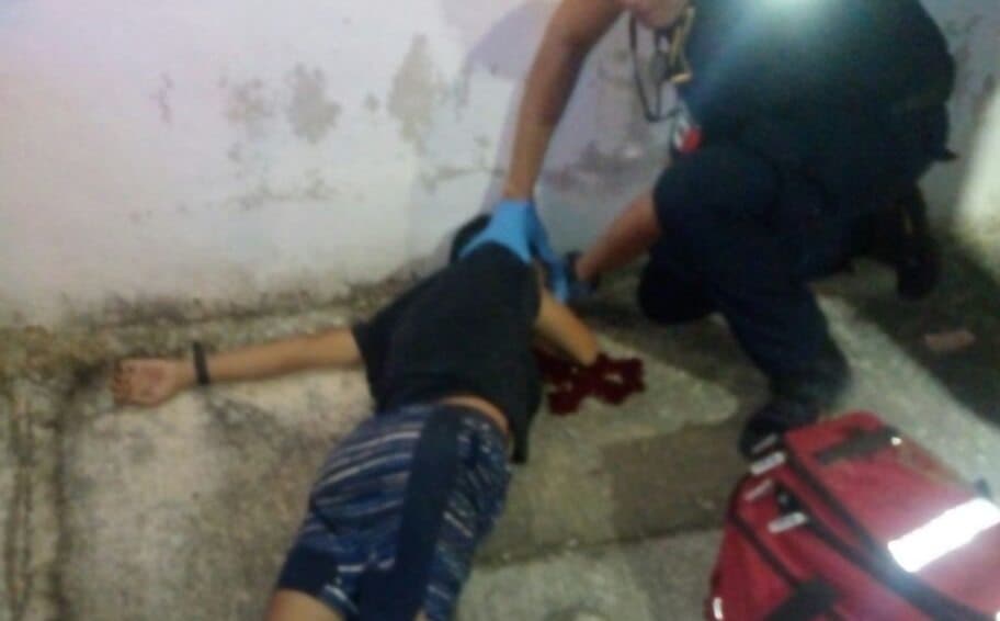 Menor atropellado en Yucatán pasa un calvario