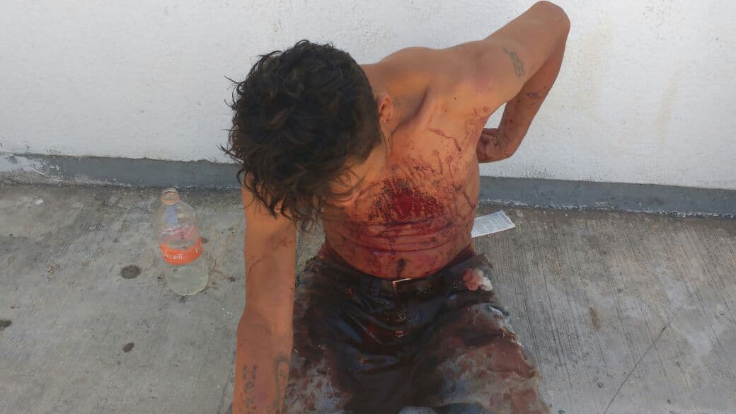 Denuncian supuesta golpiza de policías en Chetumal