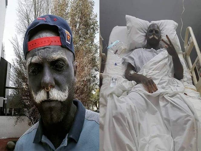 Por amor al arte sujeto extirpa sus genitales para hacerse más tatuajes