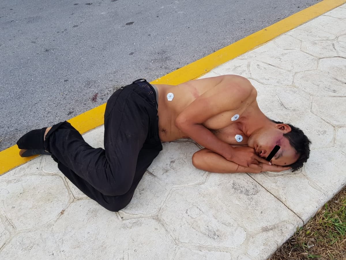 Hallan hombre con huellas de tortura; asegura que “se cayó”