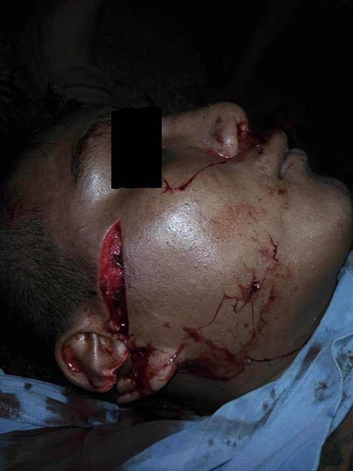 Riña deja dos heridos a machetazos en Sabán