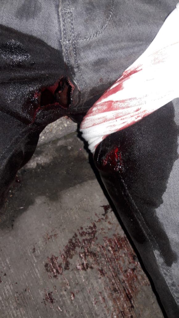 Niño es herido por arma de fuego en Playa del Carmen