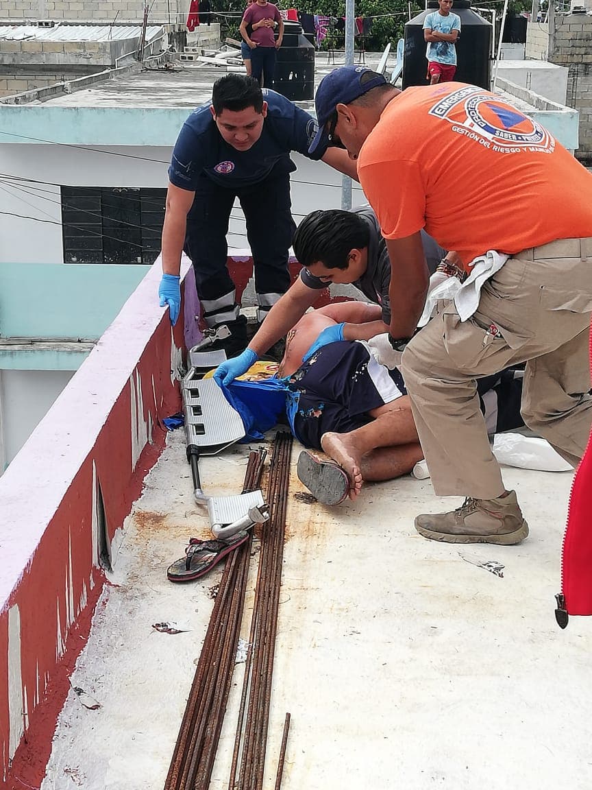 Explota su mano, tras descarga eléctrica