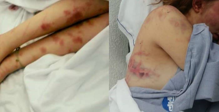 En Yucatán, cada seis horas llega al hospital una mujer golpeada por su pareja