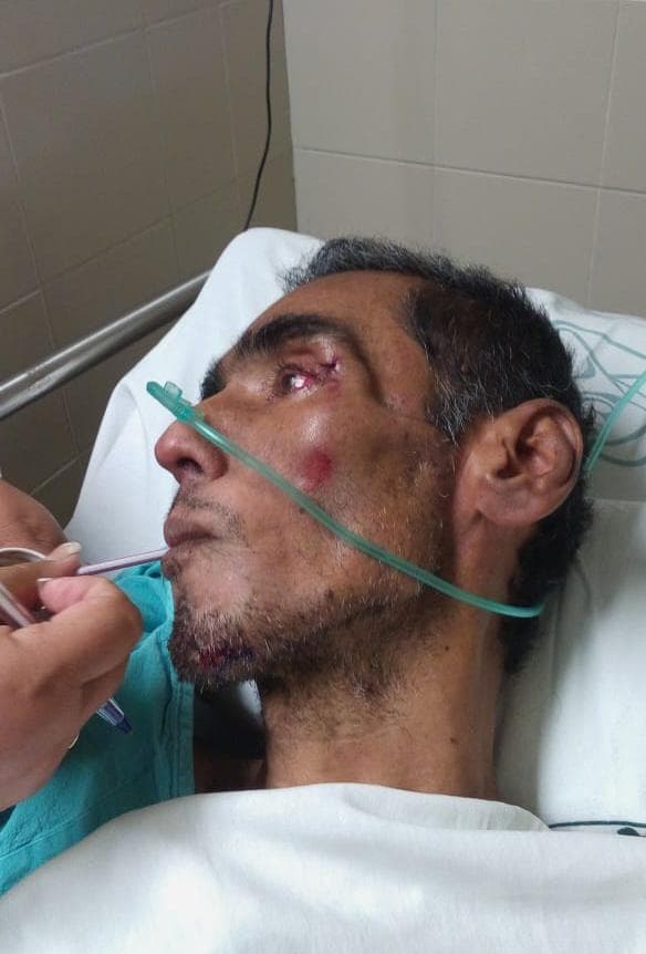 "Se les cayó" en el IMSS oficial de Tránsito y falleció