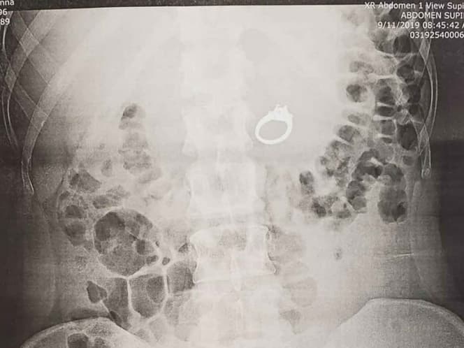 Lleva el compromiso hasta las entrañas