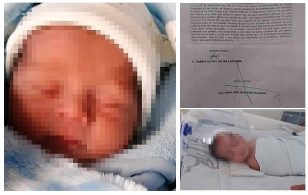 Recién nacido cae “por accidente” en ISSSTE y se fractura el cráneo