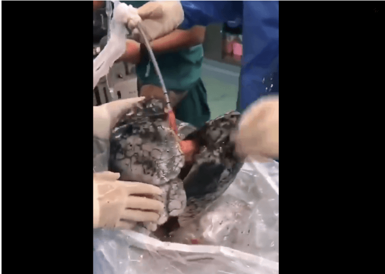 Hombre no pudo donar sus pulmones porque estaban completamente negros