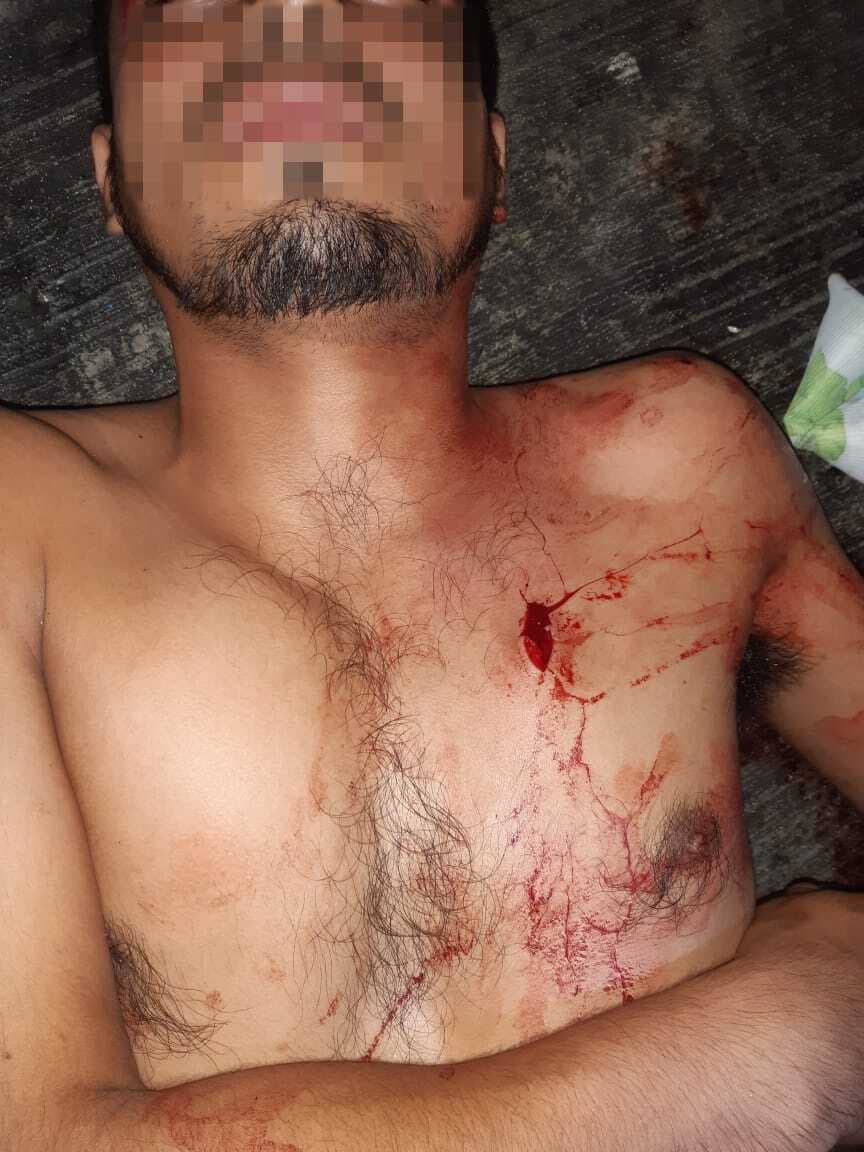 Salió apuñalados por sus amigos de parranda, en Cancún