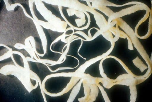 Video viral: ¡Se saca del trasero un gusano de 10 metros!