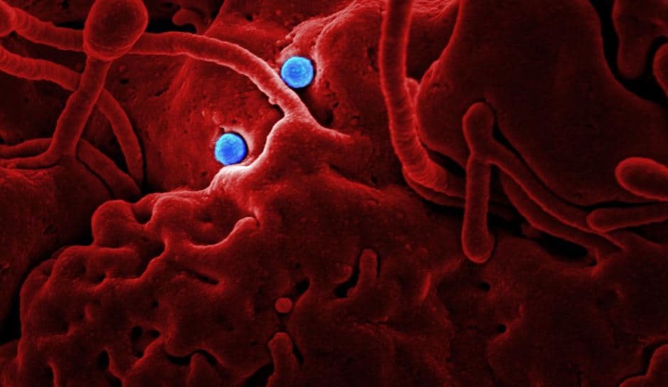 Hombre se suicida por pensar que tenía coronavirus