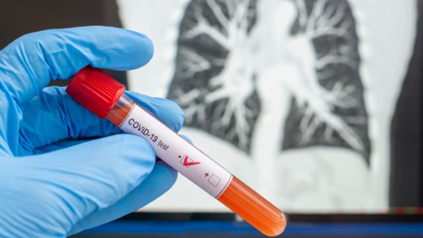 Fallece elemento de la Fiscalía, presuntamente por COVID-19