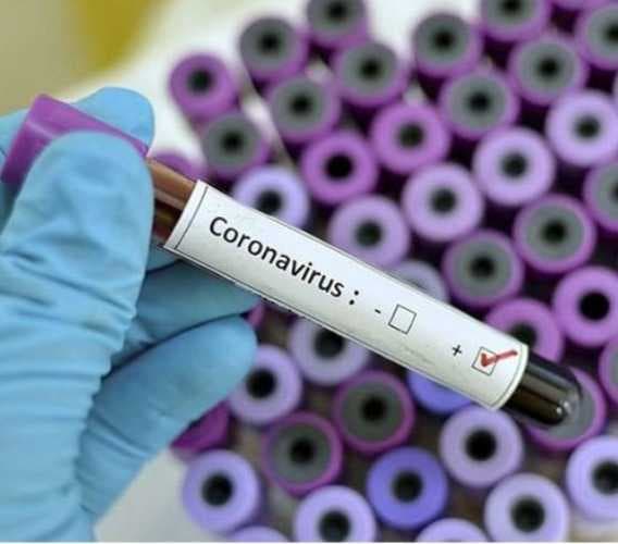 Se duplican las muertes por coronavirus en Quintana Roo; van 8 defunciones