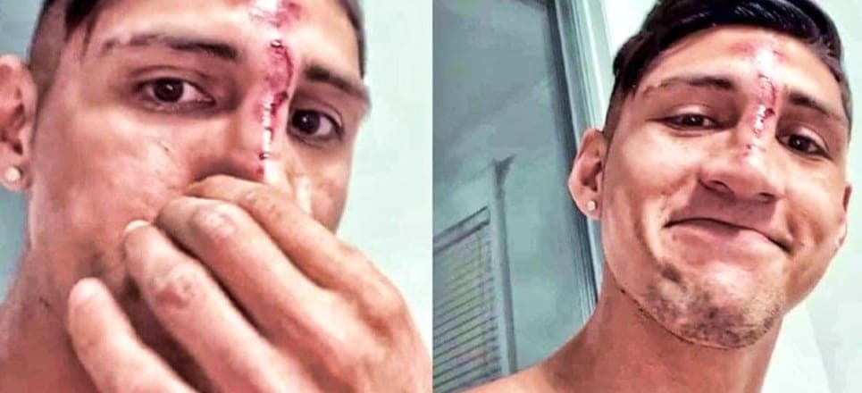 Video: Alan Pulido se rompe toda su "jefesita"  tras accidente casero