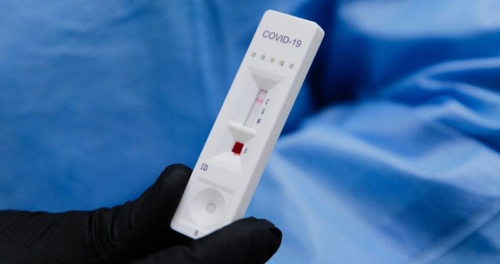 Anuncia OMS acuerdo para distribuir pruebas rápidas de Covid-19 a 133 países en desarrollo