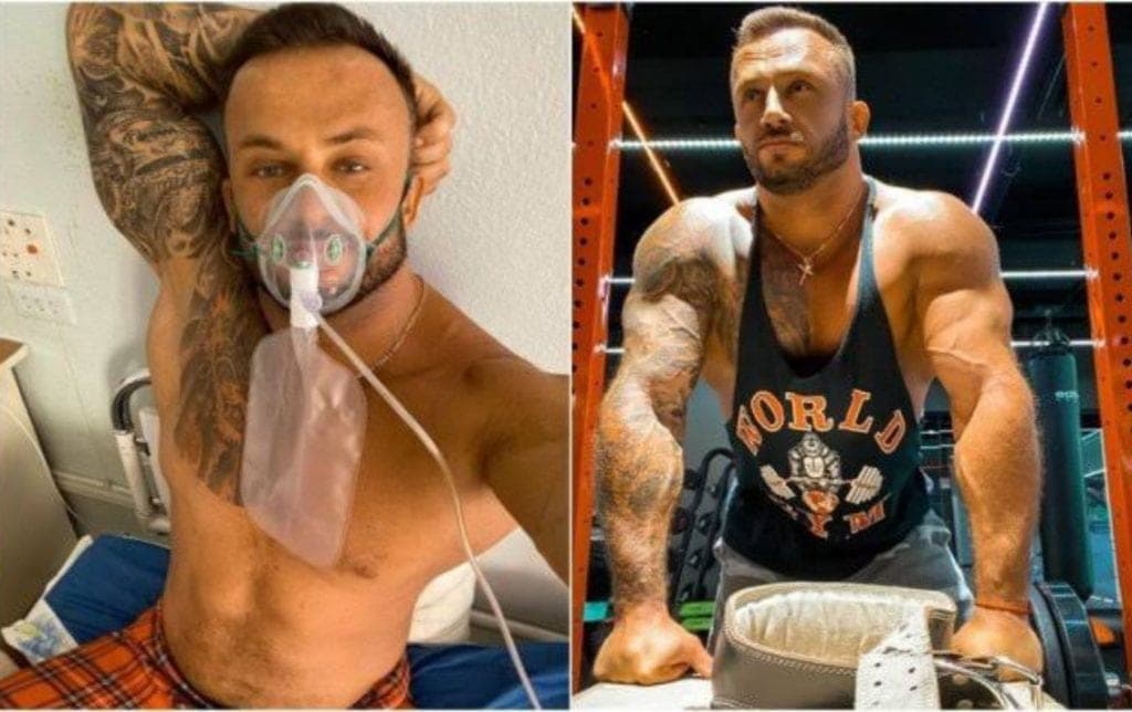 Muere influencer ucraniano de Covid-19; negaba la existencia del virus