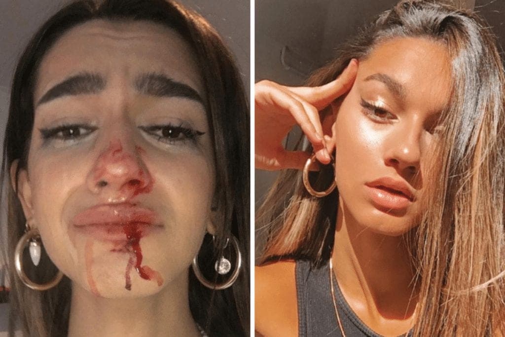 Dan tremenda golpiza a influencer por ser 'trans': 'No quiero morir mañana'