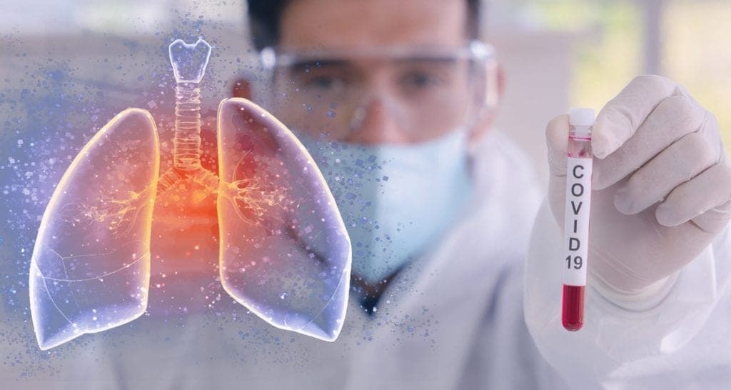 Cuatro síntomas de que probablemente tuviste Covid-19 y no te diste cuenta